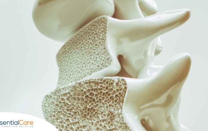 An image of a spine with the inside exposed represents osteoporosis.